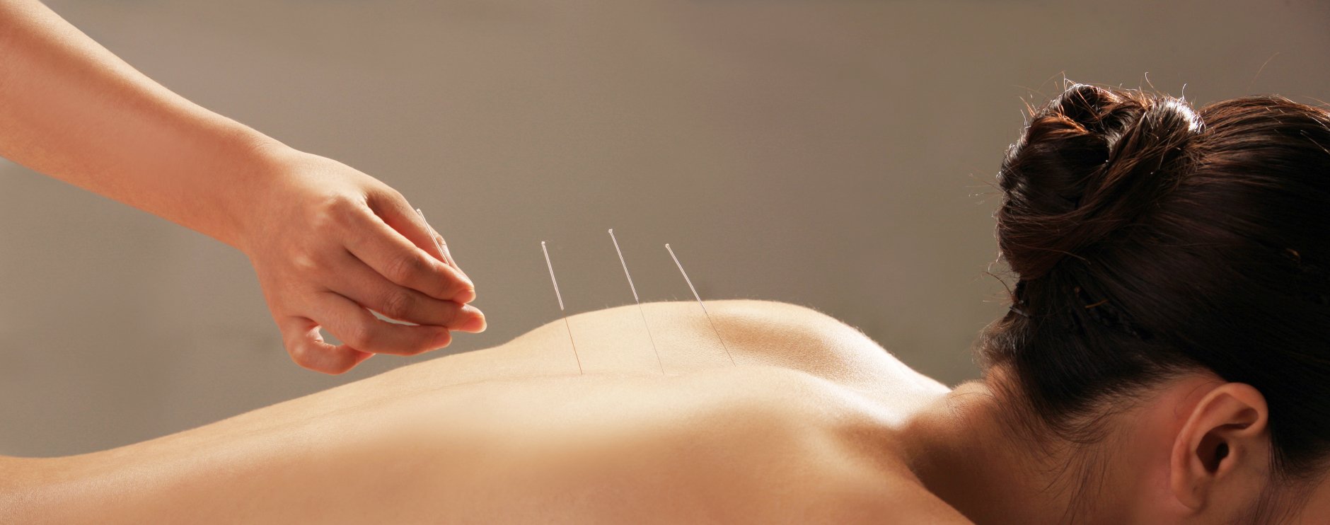 Medicina Tradicional Chinesa/Acupunctura